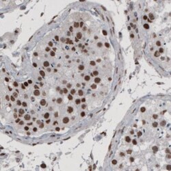 hnRNP C1 + C2 Antibody (CL2593), Novus Biologicals 0.1mL; Unlabeled:Antibodies,