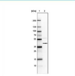 hnRNP C1 + C2 Antibody (CL2593), Novus Biologicals 0.1mL; Unlabeled:Antibodies,