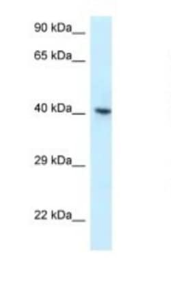 hnRNP G Antibody, Novus Biologicals 20&mu;L; Unlabeled:Antibodies, Polyclonal