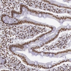 hnRNP H2 Antibody, Novus Biologicals 0.1mL; Unlabeled:Antibodies, Polyclonal