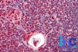 hnRNP K Antibody, Novus Biologicals:Antibodies:Primary Antibodies