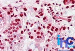 hnRNP K Antibody, Novus Biologicals:Antibodies:Primary Antibodies
