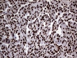 hnRNP L Antibody (OTI2E4), Novus Biologicals 0.1 mL | Buy Online | Novus Biologicals | Fisher Scientific