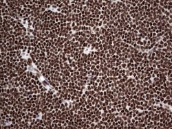 hnRNP L Antibody (OTI2E4), Novus Biologicals 0.1 mL | Buy Online | Novus Biologicals | Fisher Scientific