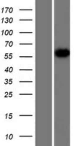 Novus Biologicals&trade;&nbsp;hnRNP-R Overexpression Lysate
