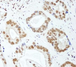 HNRNPUL1 Antibody, Novus Biologicals 0.1mL; Unlabeled:Antibodies, Polyclonal