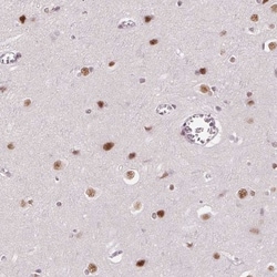 HNRPDL Antibody, Novus Biologicals 0.1mL; Unlabeled:Antibodies, Polyclonal
