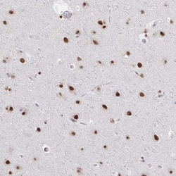 HNRPDL Antibody, Novus Biologicals:Antibodies:Primary Antibodies