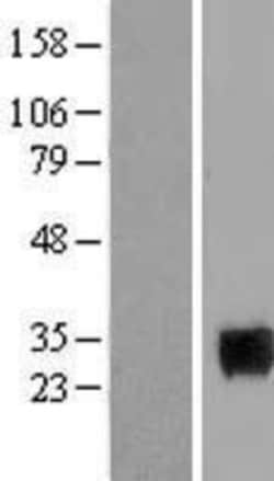 Novus Biologicals&trade;&nbsp;SIX6 Overexpression Lysate
