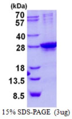 Novus Biologicals&trade;&nbsp;Recombinant Human SIX6 His Protein