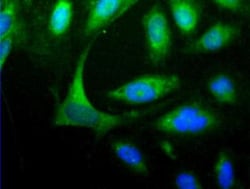 HOMER1 Antibody, Novus Biologicals 0.025mL; Unlabeled:Antibodies, Polyclonal