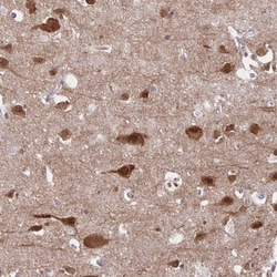 HOMER1 Antibody, Novus Biologicals 0.1mL; Unlabeled:Antibodies, Polyclonal