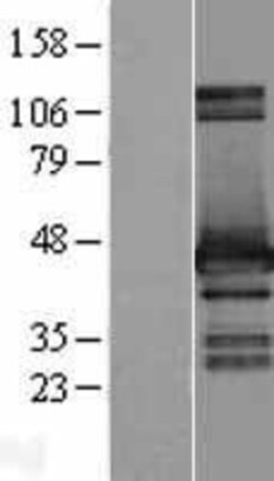 Novus Biologicals&trade;&nbsp;HOMER2 Overexpression Lysate