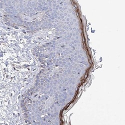 Hornerin Antibody, Novus Biologicals:Antibodies:Primary Antibodies