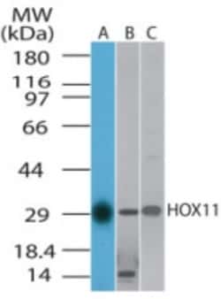 HOX11 Antibody, Novus Biologicals 0.025 mg | Buy Online | Novus Biologicals | Fisher Scientific