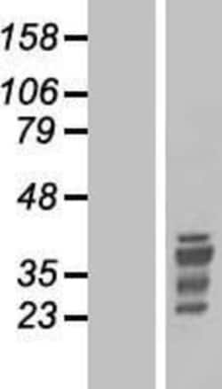 Novus Biologicals&trade;&nbsp;HOX11 Overexpression Lysate