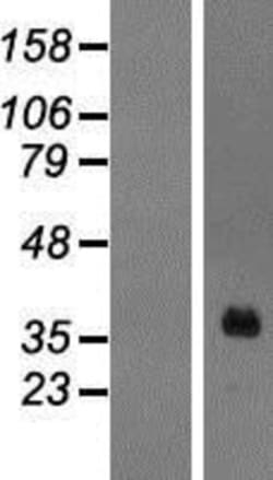 Novus Biologicals&trade;&nbsp;HOXA1 Overexpression Lysate