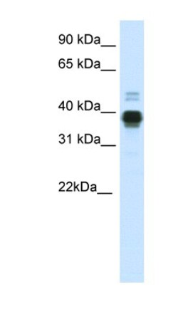 HOXA11 Antibody, Novus Biologicals 0.05mg; Unlabeled:Antibodies, Polyclonal