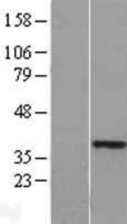 Novus Biologicals&trade;&nbsp;HOXA11 Overexpression Lysate
