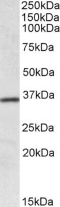 HOXA4 Antibody, Novus Biologicals 0.1mg; Unlabeled:Antibodies, Polyclonal