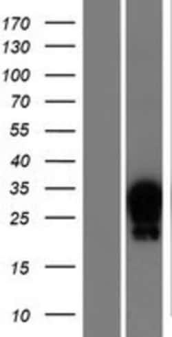 Novus Biologicals&trade;&nbsp;HOXA7 Overexpression Lysate