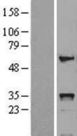 Novus Biologicals&trade;&nbsp;HOXB5 Overexpression Lysate