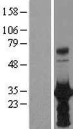 Novus Biologicals&trade;&nbsp;HOXB6 Overexpression Lysate
