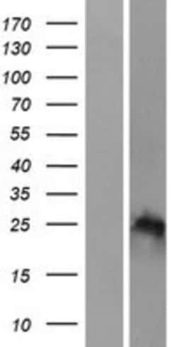 Novus Biologicals&trade;&nbsp;HOXB7 Overexpression Lysate