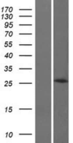 Novus Biologicals™ HOXB8 Overexpression Lysate