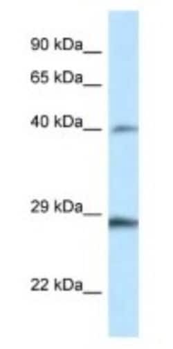 HOXB9 Antibody, Novus Biologicals 100 &mu;L | Buy Online | Novus Biologicals | Fisher Scientific