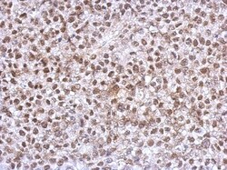 HOXC10 Antibody, Novus Biologicals 0.1mL; Unlabeled:Antibodies, Polyclonal