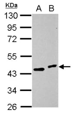 HOXC10 Antibody, Novus Biologicals 0.1mL; Unlabeled:Antibodies, Polyclonal