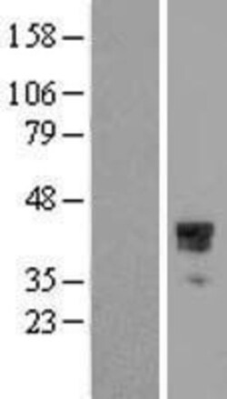 Novus Biologicals&trade;&nbsp;HOXC10 Overexpression Lysate