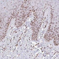 HOXC10 Antibody, Novus Biologicals 0.1mL; Unlabeled:Antibodies, Polyclonal