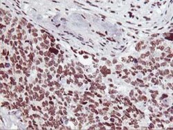 HOXC11 Antibody (OTI3E10), Novus Biologicals 0.1mL; Unlabeled:Antibodies,