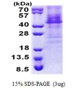 Novus Biologicals&trade;&nbsp;Recombinant Human HOXC11 His Protein