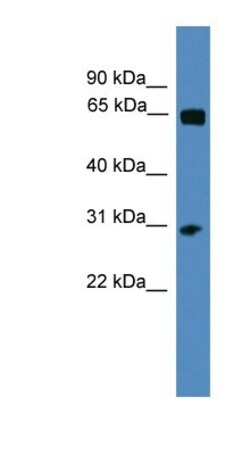 HOXC12 Antibody, Novus Biologicals 100 &mu;L | Buy Online | Novus Biologicals | Fisher Scientific