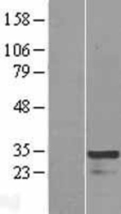 Novus Biologicals&trade;&nbsp;HOXC4 Overexpression Lysate