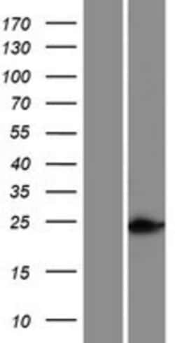 Novus Biologicals&trade;&nbsp;HOXC5 Overexpression Lysate