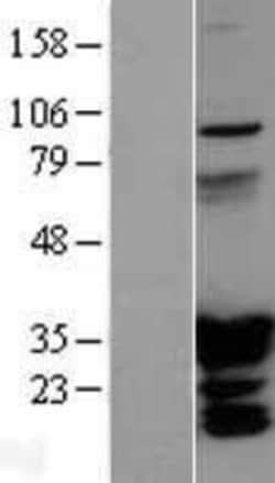 Novus Biologicals&trade;&nbsp;HOXC6 Overexpression Lysate