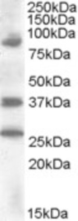HOXD10 Antibody, Novus Biologicals 0.1mg; Unlabeled:Antibodies, Polyclonal