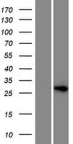Novus Biologicals&trade;&nbsp;HOXD12 Overexpression Lysate