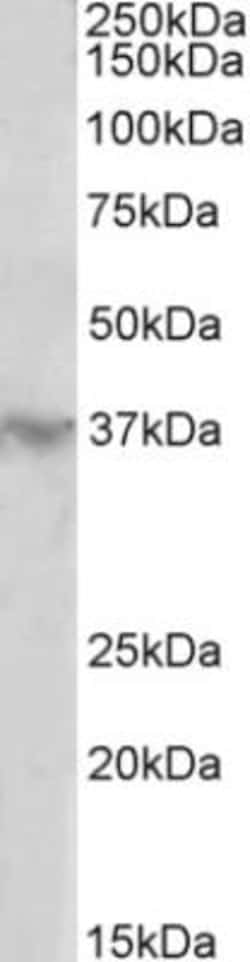 HOXD12 Antibody, Novus Biologicals 0.1mg; Unlabeled:Antibodies, Polyclonal
