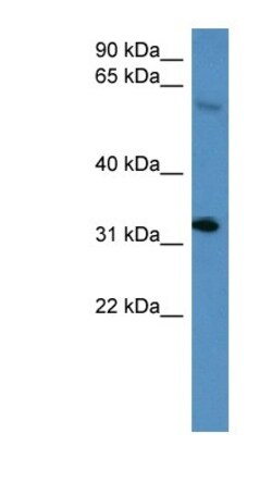 HOXD13 Antibody, Novus Biologicals 100μL; Unlabeled:Antibodies, Polyclonal