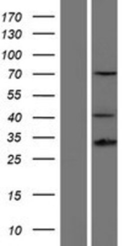 Novus Biologicals&trade;&nbsp;HOXD13 Overexpression Lysate