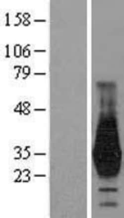 Novus Biologicals&trade;&nbsp;HOXD4 Overexpression Lysate