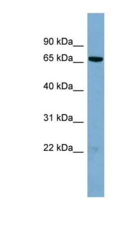 HP1BP3 Antibody, Novus Biologicals 0.05mg; Unlabeled:Antibodies, Polyclonal