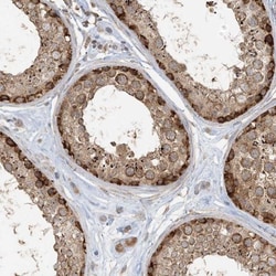 HPCL Antibody, Novus Biologicals:Antibodies:Primary Antibodies