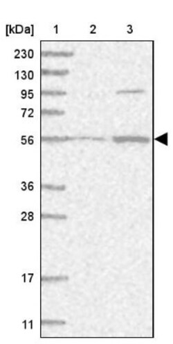 HPCL Antibody, Novus Biologicals:Antibodies:Primary Antibodies