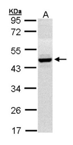 HPD Antibody, Novus Biologicals 0.1mg; Unlabeled:Antibodies, Polyclonal